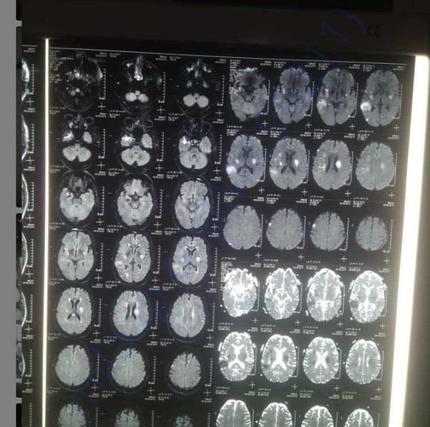 Medical Report