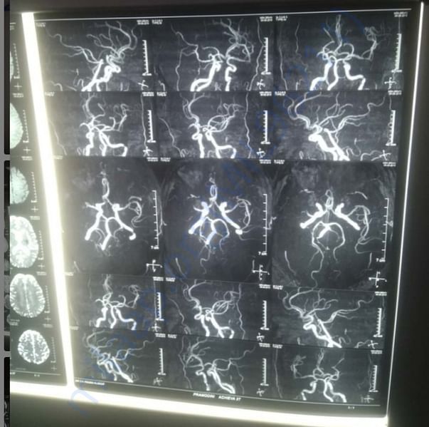 Medical Report