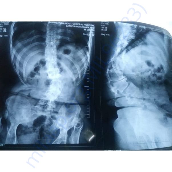 Medical Report