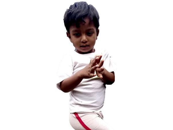 Ullas need help for Bone marrow transplant due to major Thalassemia