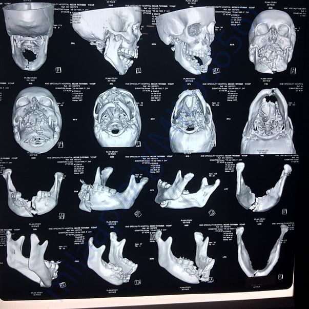 Medical Report