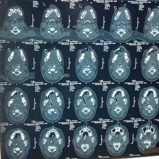 Medical Report