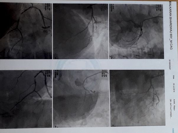 Help Me Undergo Heart Surgery