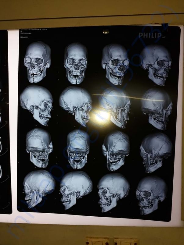 Xray report