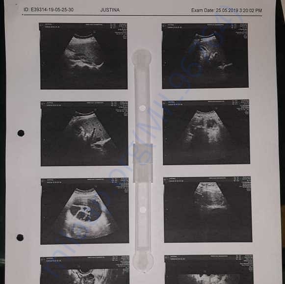 Medical Report