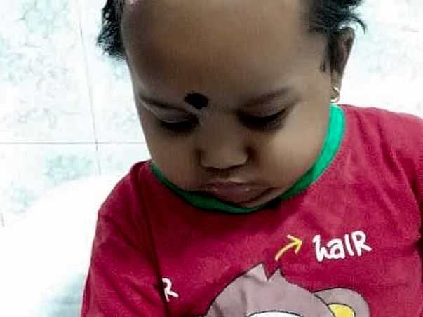 Please Help My 18 Month Old Child Fight Acute Lymphoblastic Leukemia