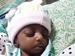 Help 23 days old Sheeba's Baby - Congenital Heart Disease and Abdomine
