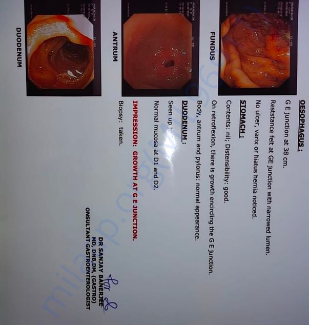 Endoscopy report