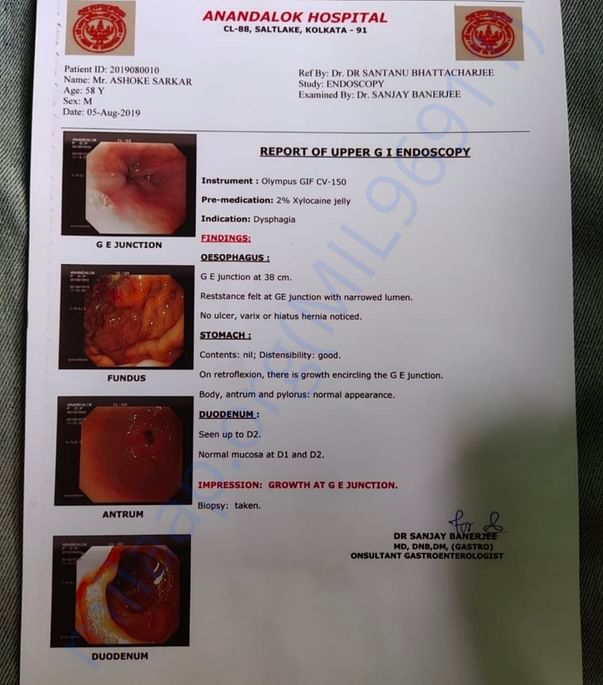 Endoscopy reportt