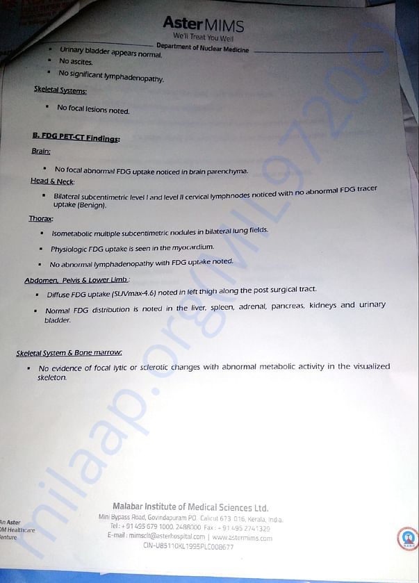 Pet scan result