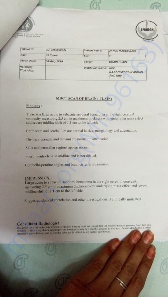 CT scan Report