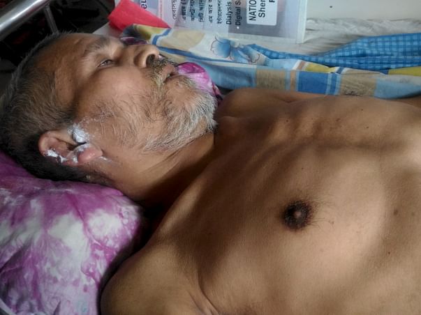 Help My Uncle Faraque To Recover From Pott's Disease.