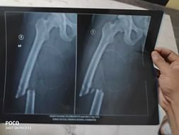 Help My Friend Who Met With Accident