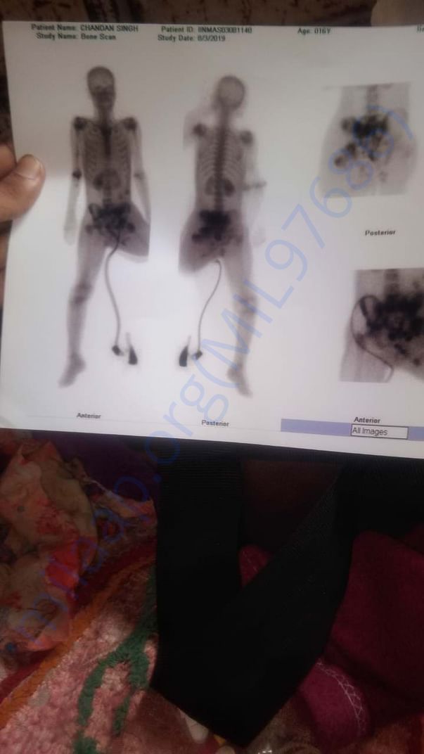 Body Scan of Patient