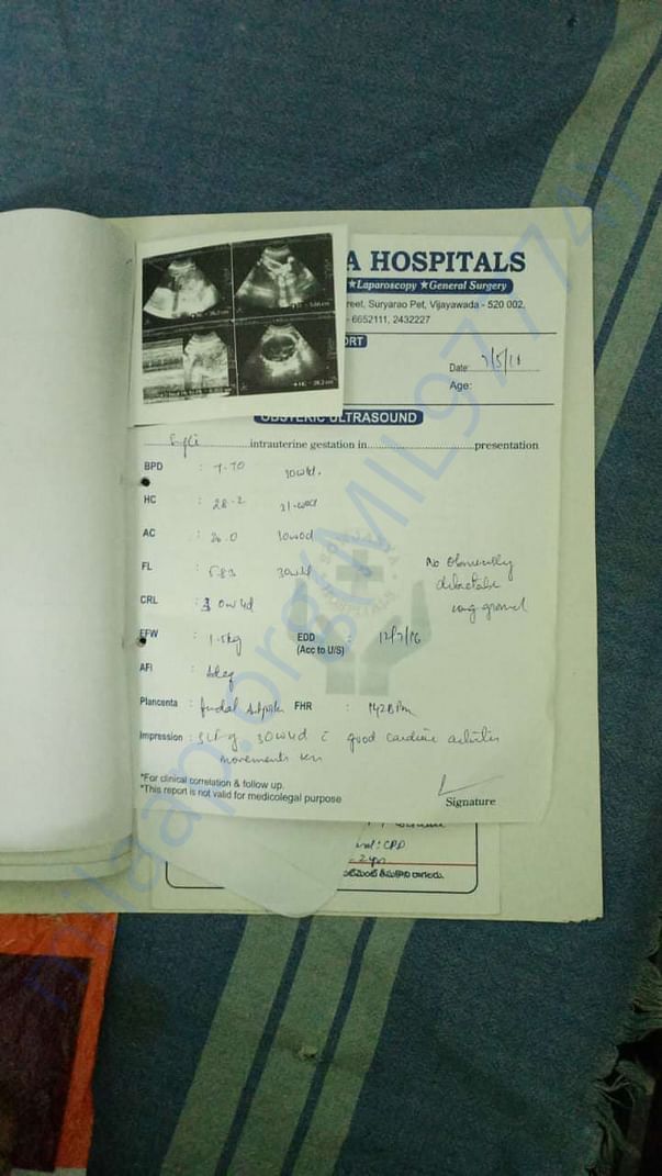 Document