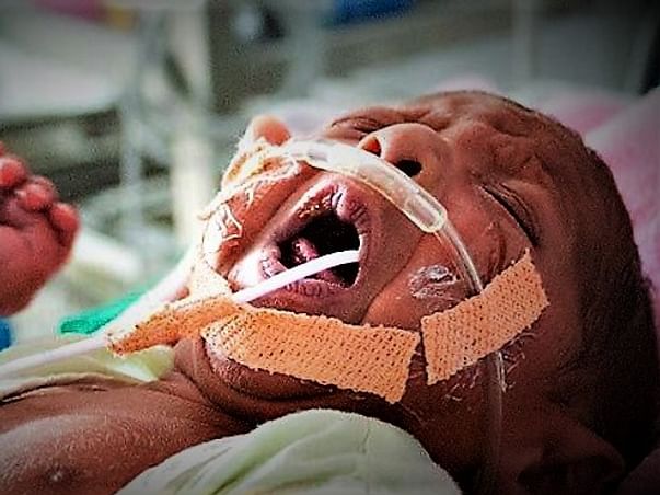 This Baby Is Just 1-Month-Old But He Needs A Transplant In 8 Days