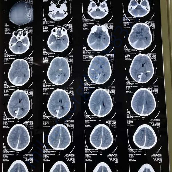 Medical Report