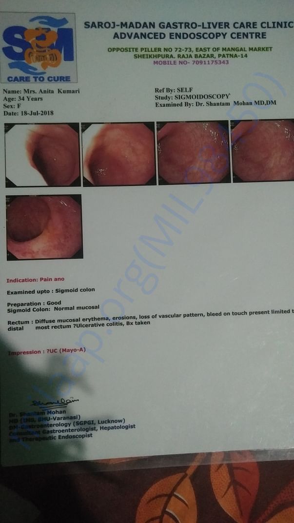 Ulcer