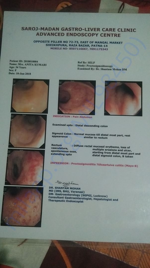 Ulcer