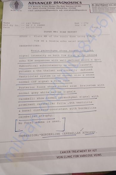 Detail mention by Doctor about brain attack