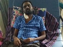 Help Nagoor Babu Fight Multi Organ Failure