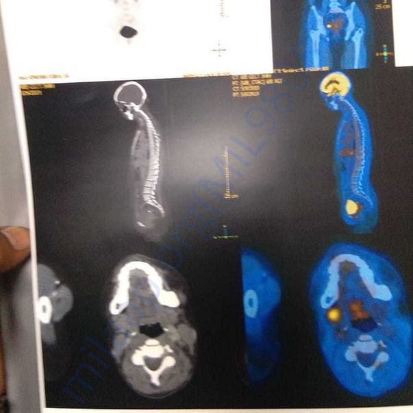 Medical Bill
