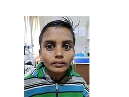 Help Sunil who cannot Speak nor Hear for his Eye Surgery