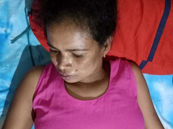 Help My Sister Fight Epilepsy