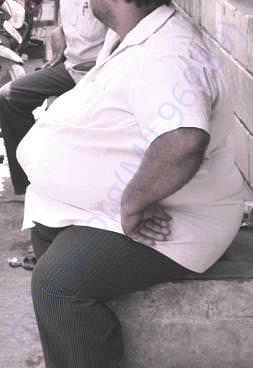 Obesity affects over 5% (7 crores) of the country's population