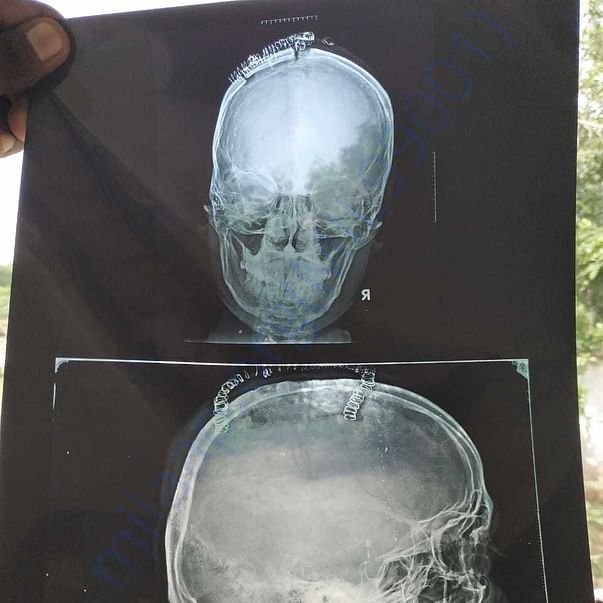 Medical Report