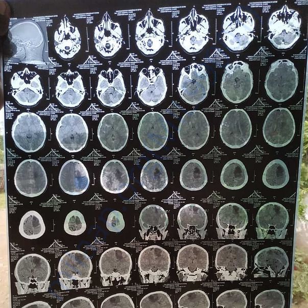 Medical Report