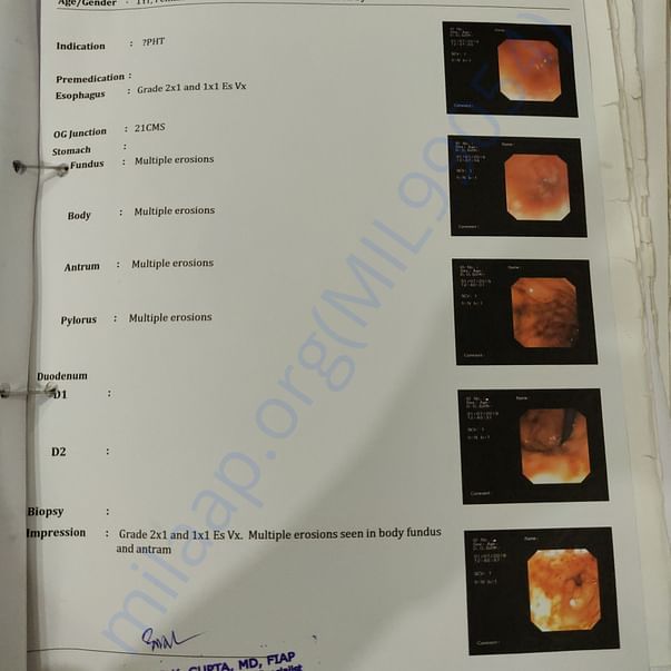 Jaundice report before admission to hospital