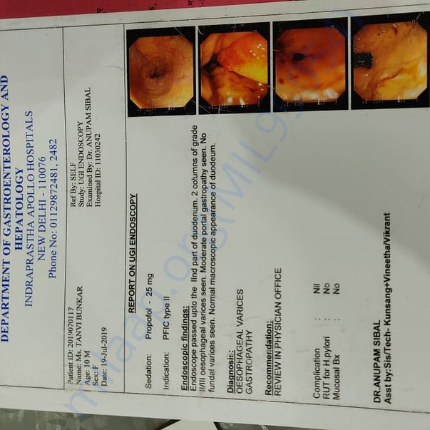 Endoscopy showcasing her liver infection