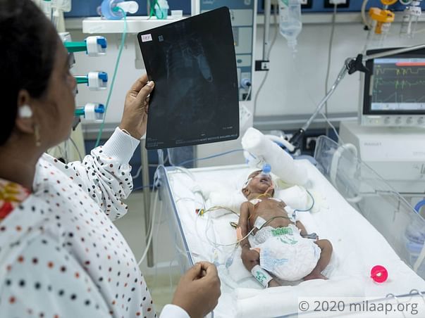 Help Baby of Sonal Recover From Complete Heart Block