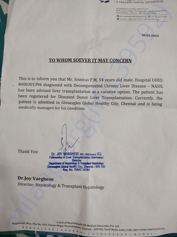 Srinivas pm liver transplant
