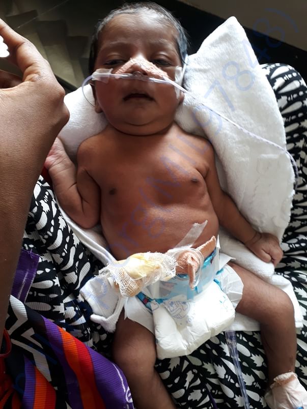First touch by his mother after 21 days in hospital