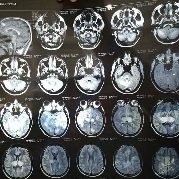 Medical Report