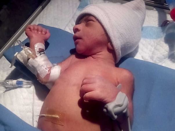 Help My Premature Baby Son To Recover From ICU