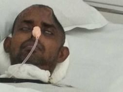 Help My Uncle Who Met With Road Accident