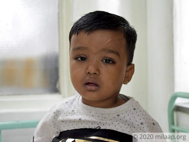Help Shaurya Pardeshi Fight Biliary Atresia