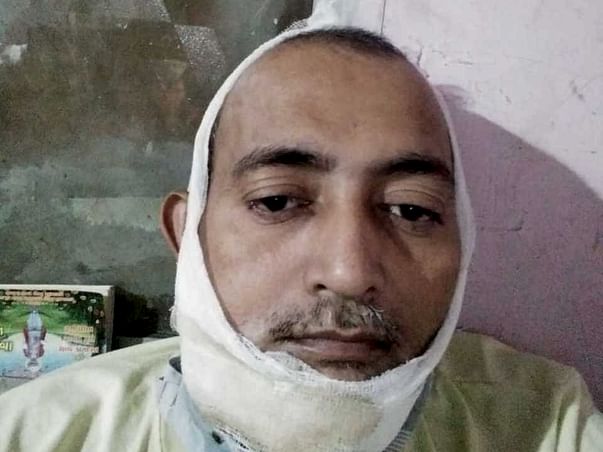 Help Mukesh Fight Oral Cancer