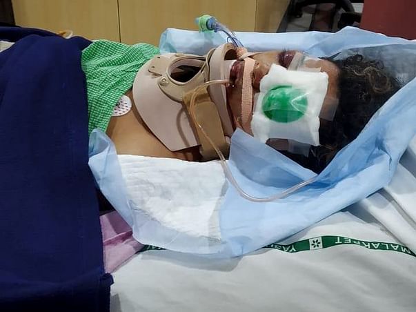 Please Help Our Friend Bhargav Recover From An Accident!