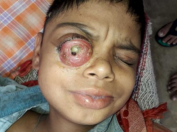 Help My 12 Years Old Son Vansh Fight Cancer.