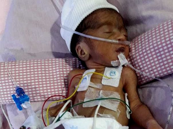 Help Premature Born Roja Fight For Life!