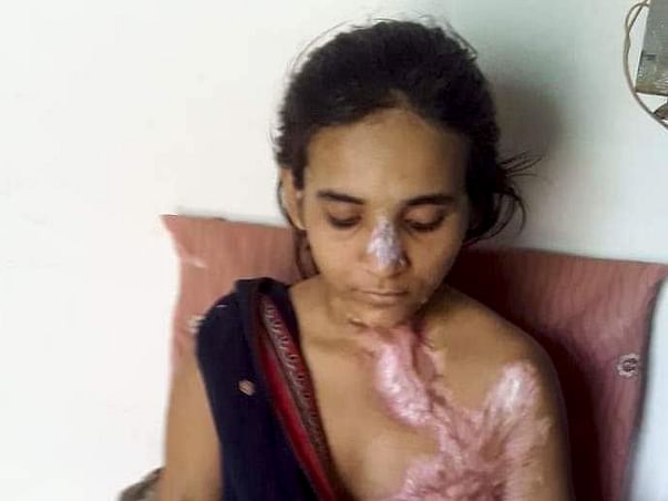 Help khushi fight to live with dignity