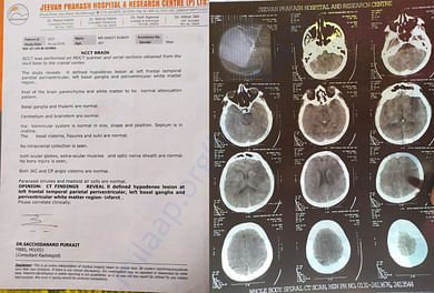 CT Scan July 18