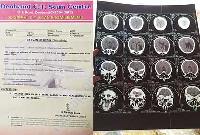CT Scan February 19