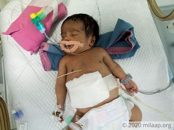 Help Baby of Fathima Ahmed Survive