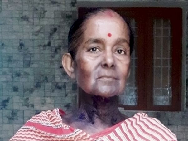 Help My Aunt, Sukla Dey, To Live a Life Free From Cancer