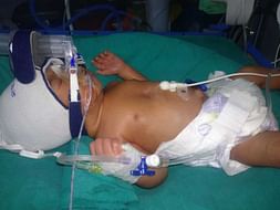 Help My Baby Recover From Respiratory Distress Syndrome